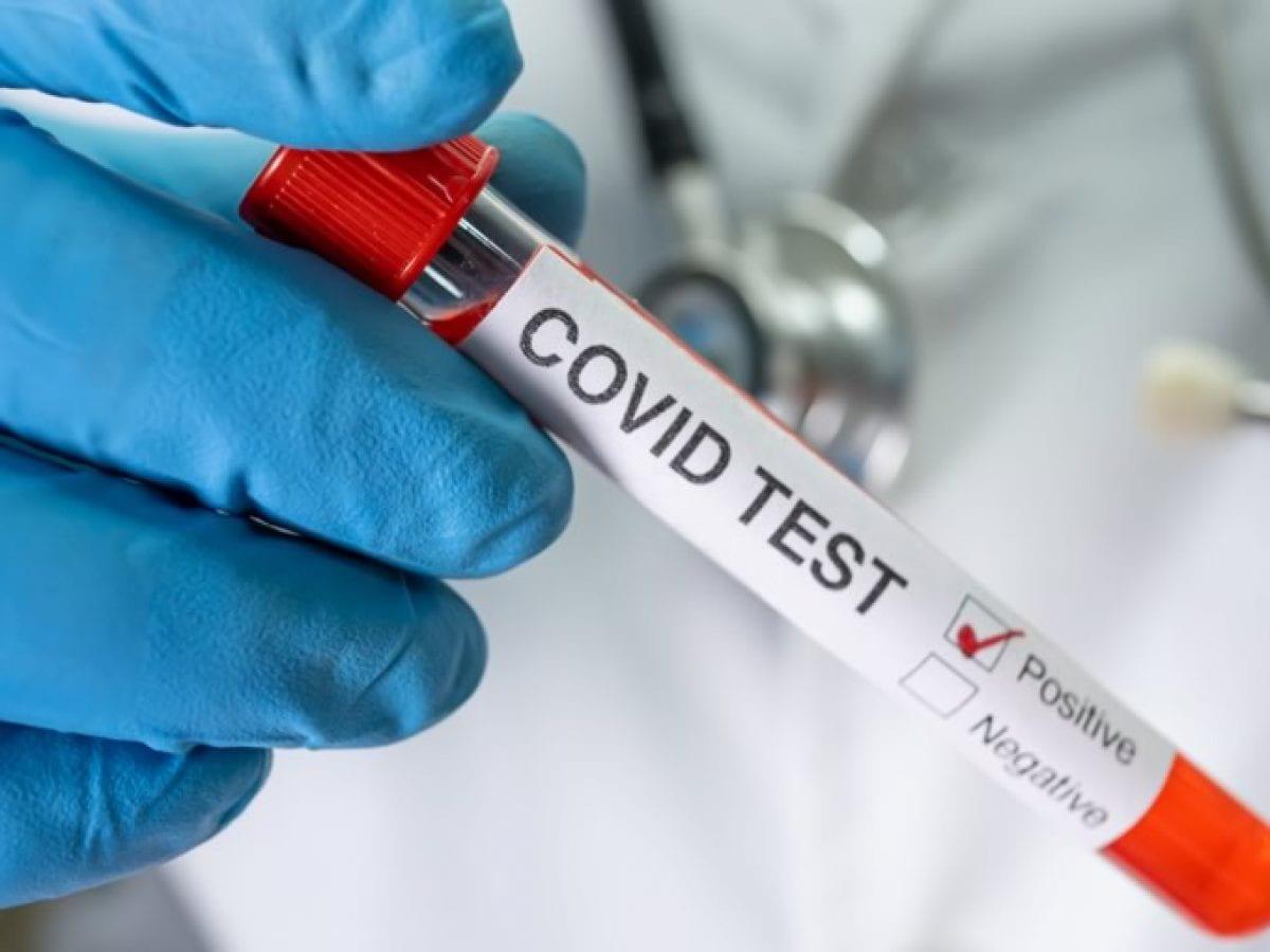 COVID-19 Testing Available on Campus